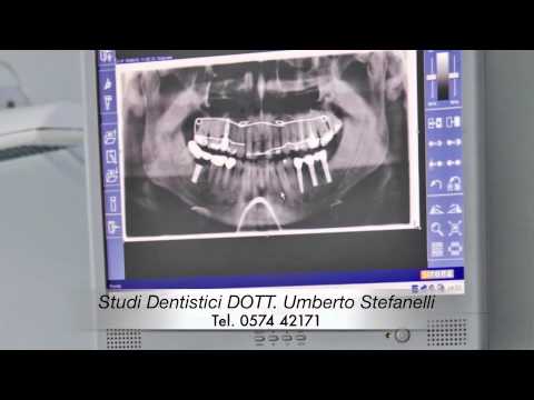Studi dentistici dott. umberto stefanelli 3 youtube Studio dentistico stefanelli