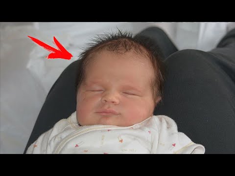 Когда этот новорождённый открыл глаза, акушеры оцепенели от увиденного!