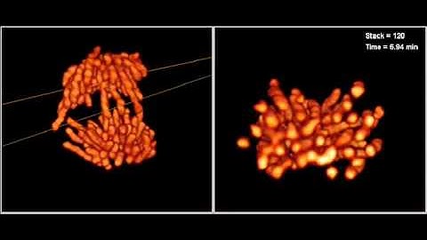 Bessel Beam Plane Illumination Microscopy | Mitosis