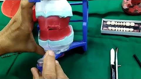 Maxillary Anterior Teeth Arrangement