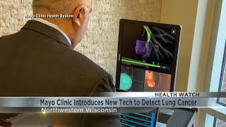 Mayo Clinic introduces new tech to help detect lung cancer