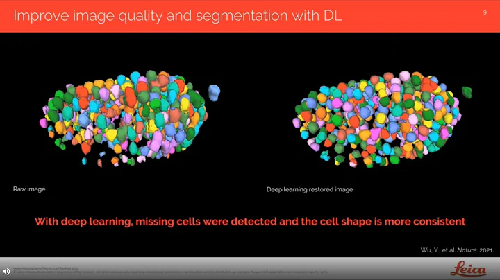 Stretching the Limits of Microscopy Imaging with Deep Learning