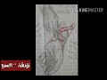 رسم ايد مجروحه    