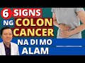 6 Signs ng Colon Cancer. Na Hindi Mo Alam. - By Doc Willie Ong (Internist and Cardiologist)