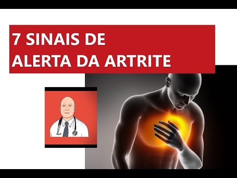 Os 7 sinais de alerta para complicações graves da artrite reumatoide.