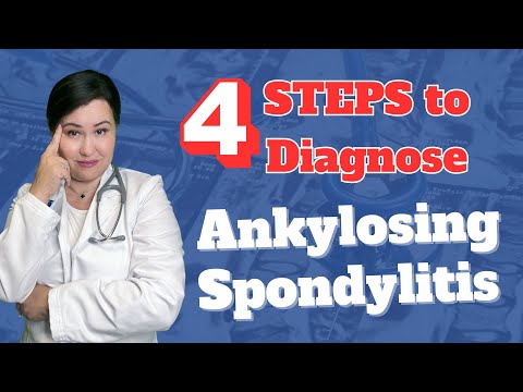4 Steps To diagnose Ankylosing Spondylitis