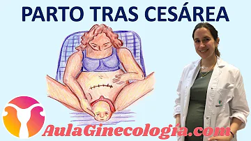 ¿Cuáles son los riesgos del parto natural después de una cesárea?