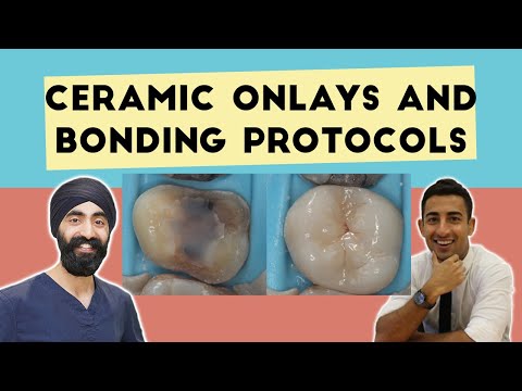 Ceramic Onlays from Preps, Temporaries and Bonding Protocols - PDP059