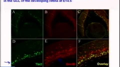Gene Regulatory Networks In Retinal Development and Degeneration