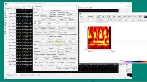 MEG/EEG Time Frequency Analysis 02