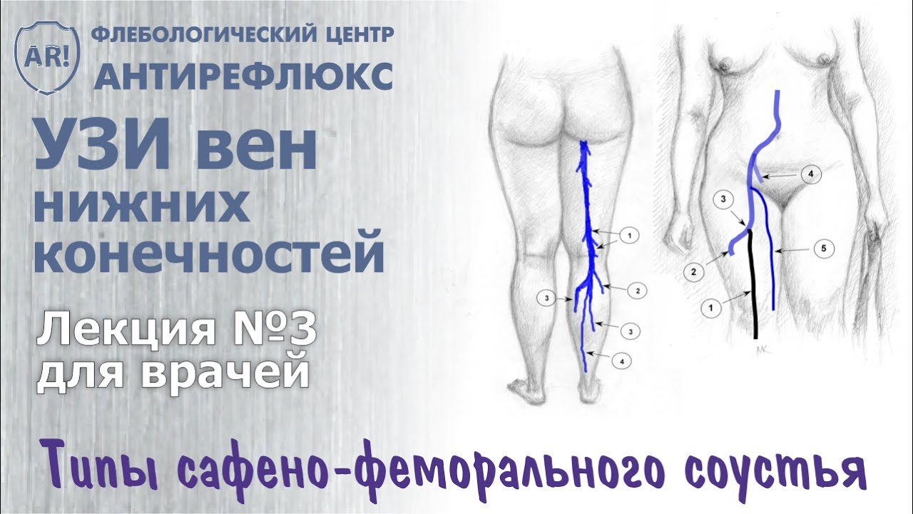 УЗИ вен нижних конечностей УЗИ вен нижних конечностей