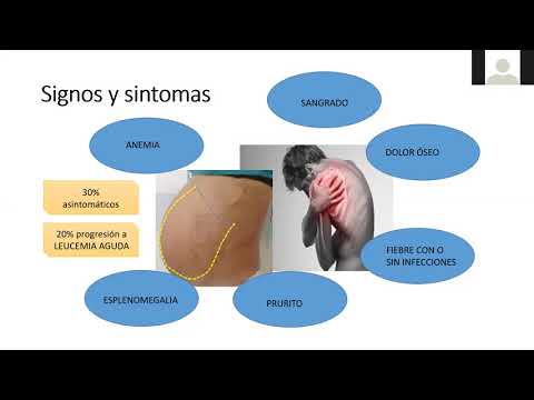 Vídeo: Síntomas Y Complicaciones De La Mielofibrosis