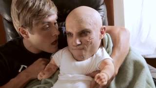 Charlie Zombie Bit My Finger...off