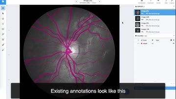 💊Medical image analysis with Supervisely - Human in the loop AI
