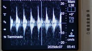 Sonosite 180 Plus B