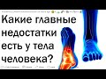 Какие минусы есть в наших телах?