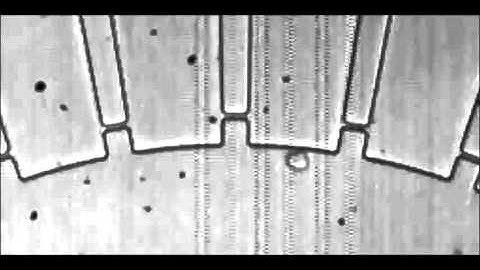 Microfluidic enrichment for the single cell analysis of circulating tumor cells