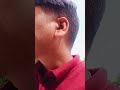 आज में केरी तोड़ा कच्चा