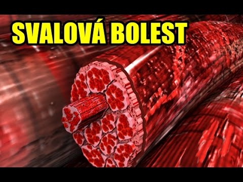 Video: Prečo ma bolí sternokleidomastoidný sval?