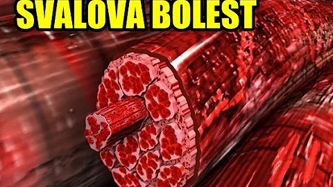 Jaké jsou typy svalových vláken?