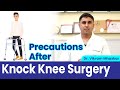 Post knock knee surgery  precautions after knock knee treatment recovery after knock knee surgery