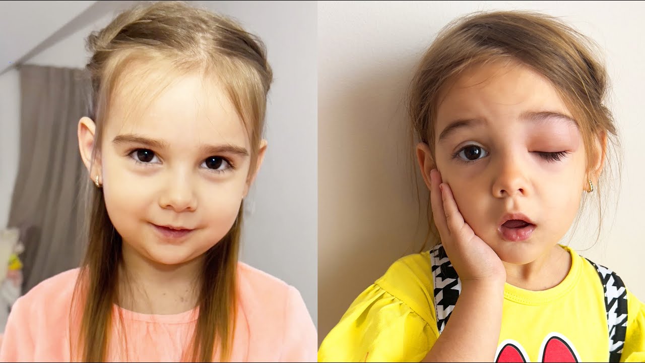 🚨 Ce a Pățit BRIANA 👩🏻‍🦰 la OCHIȘOR 👁 ? 🦟