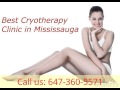 Best Cryotherapy ClinicCooksville 647 360 5571 Best Cryotherapy ClinicCooksville 647 360 5571