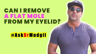 CAN I REMOVE A FLAT MOLE FROM MY EYELID?
