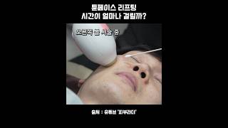 튠페이스, 실제 시술영상
