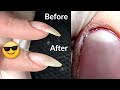 How to fix a Curved Nail | Manicure Transformation