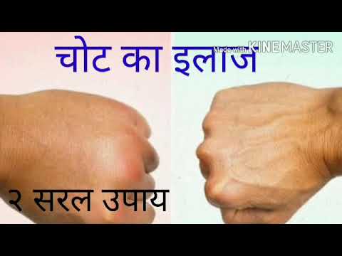 सभी प्रकार की चोटों के लिए || घरेलू उपाय