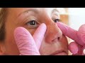 Was ist mit Nadja’s Nase passiert? Teil 1 👃🏻