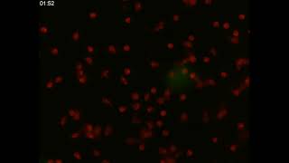 Live cell imaging of healthy neutrophils.