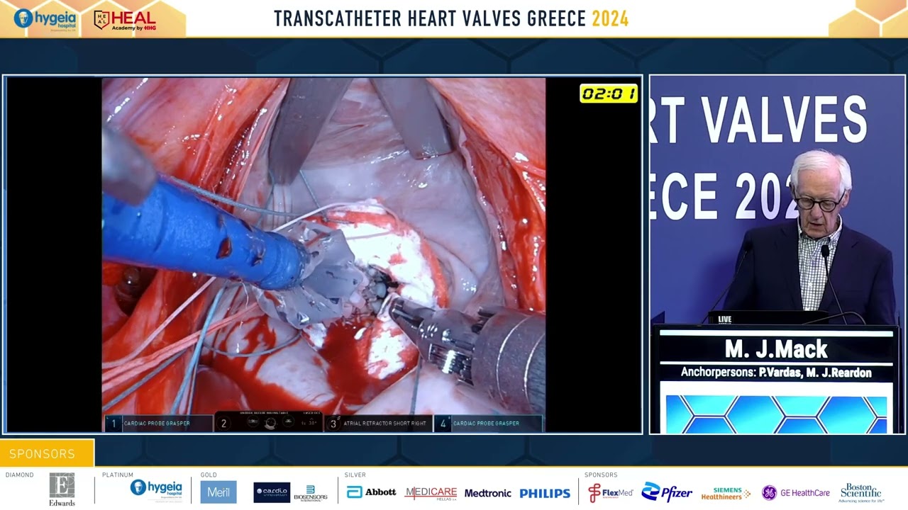 M. Mack | Mitral annular calcification: When and how to treat?