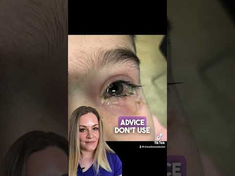 Treating Pink Eye (Conjunctivitis) at Home: Best and Worst Advice