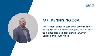 Mr. Dennis Ngosa - Non-TB Abnormalities in Digital Chest X-rays: High CAD4TB Scores
