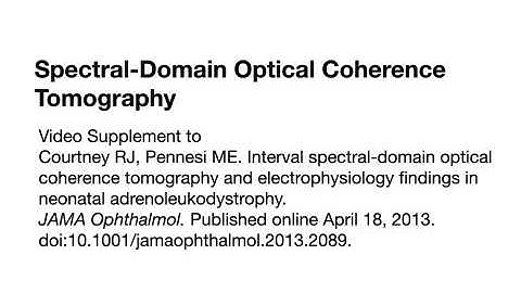 Spectral-Domain Optical Coherence Tomography