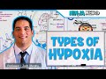 Types of Hypoxia: Hypoxemic | Anemic | Stagnant | Histotoxic