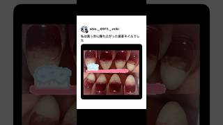 真っ赤に腫れあがった歯茎みたいなネイル・・・
