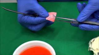 Handling Ossix Plus Resorbable Membran