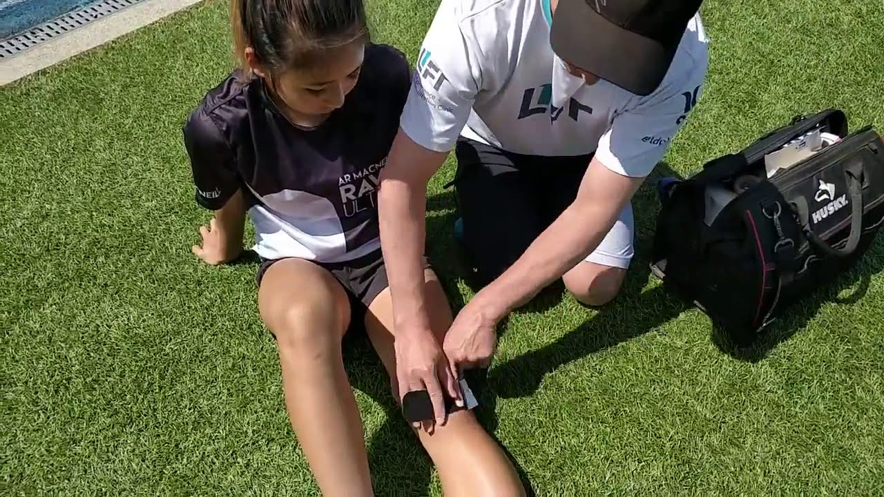 High speed taping for jumper's knee / patellofemoral pain YouTube