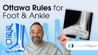 Ottawa Rules for Foot and Ankle | Expert Physio Explains