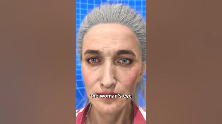 23 Contacts Stuck In Her Eye 😨