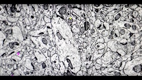 Lecture 8: What is the Connectome?