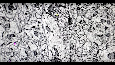 Lecture 8: What is the Connectome?