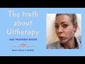 The truth about Ultherapy | Alice Hart-Davis