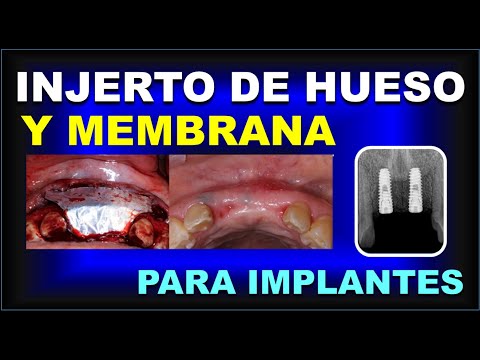 Vídeo: Què fan els canals de membrana?