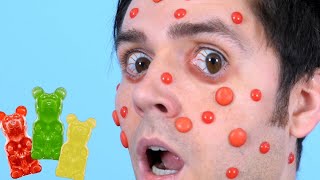 CANDY ALLERGIC REACTION!
