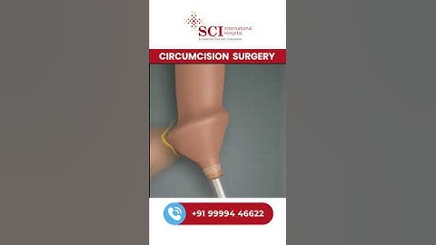 Pain-Free Circumcision? Stapler Technique Explained! ✅ #scihealthcare #healthawareness