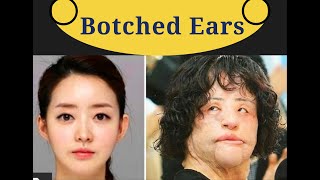 Plastic Surgery Gone Wrong & Botched Woman humiliated in Houston TX  Fixed by Dr Azul - LIVE SURGERY